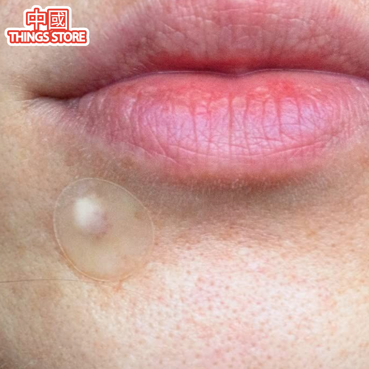 Parches para el acné