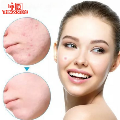 Parches para el acné