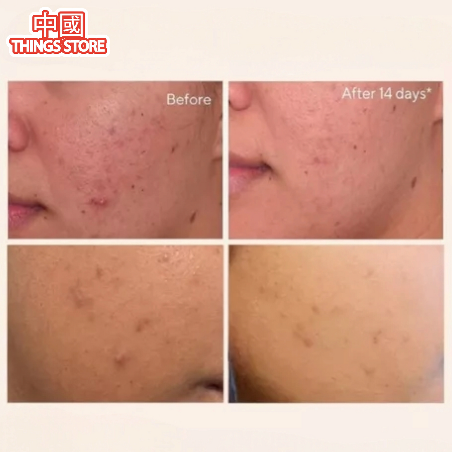 Serum de arroz para el rostro